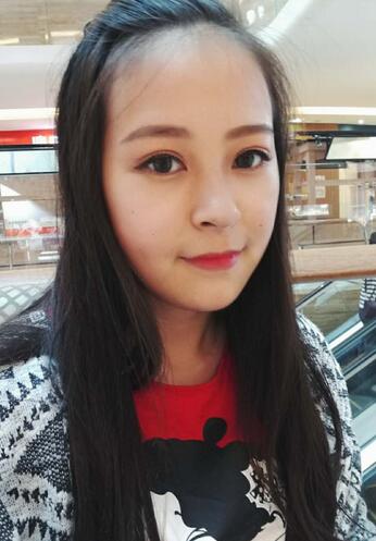 梨花雨割双眼皮恢复半年了