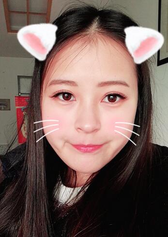 梨花雨割双眼皮恢复半年了