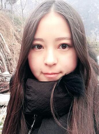 梨花雨割双眼皮恢复半年了