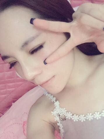 梨花雨隆鼻整形的恢复经历