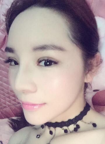 梨花雨隆鼻整形的恢复经历