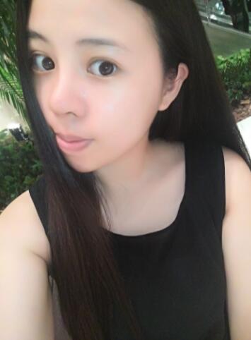 隆鼻整形真实恢复期图片 隆鼻整形一个月了