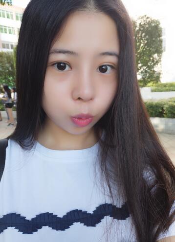 隆鼻整形真实恢复期图片 隆鼻整形一个月了