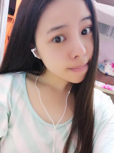 隆鼻整形真实恢复期图片 隆鼻整形一个月了