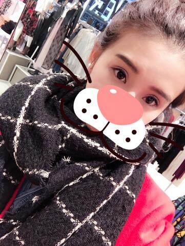 上海韩镜割双眼皮一个月