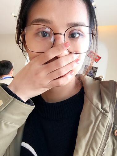 上海韩镜割双眼皮一个月