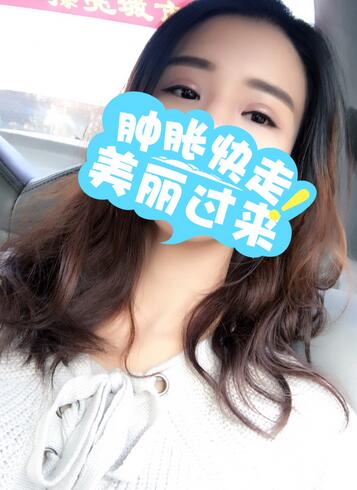 上海韩镜割双眼皮一个月