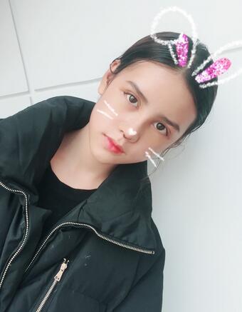 上海韩镜网红套餐半个月经历 双眼皮多项整形+隆鼻整形+脂肪填充