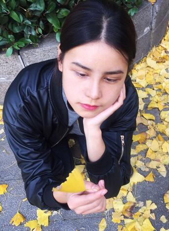 上海韩镜网红套餐半个月经历 双眼皮多项整形+隆鼻整形+脂肪填充