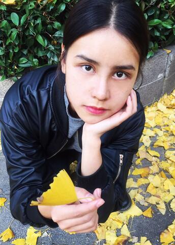 上海韩镜网红套餐半个月经历 双眼皮多项整形+隆鼻整形+脂肪填充