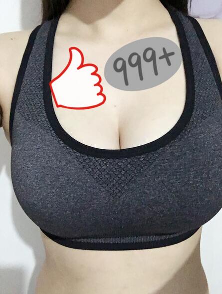 上海韩镜曼托假体隆胸18天