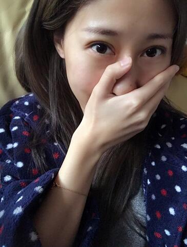 埋线双眼皮七天恢复图