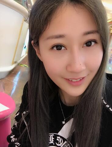 埋线双眼皮七天恢复图