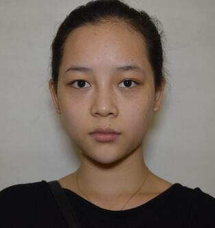 深圳晨曦微创定点每天恢复图 美爆了~