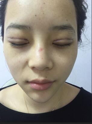 深圳晨曦微创定点每天恢复图 美爆了~