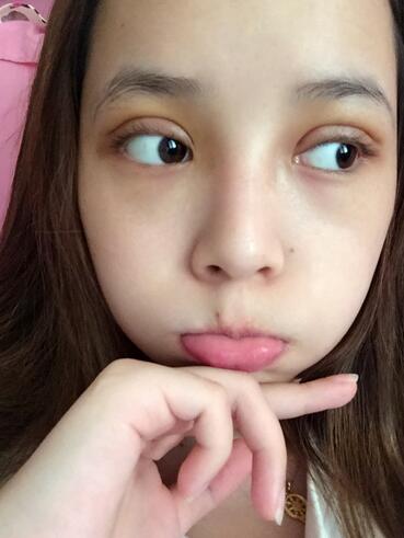 深圳晨曦微创定点每天恢复图 美爆了~