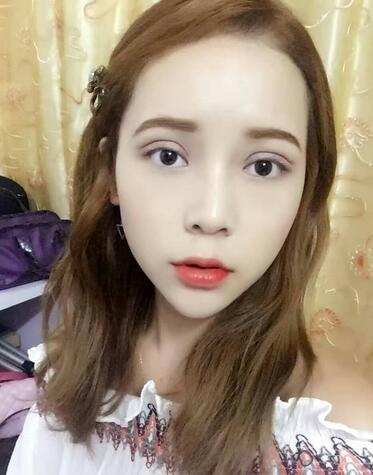 深圳晨曦微创定点每天恢复图 美爆了~