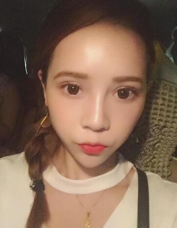 深圳晨曦微创定点每天恢复图 美爆了~