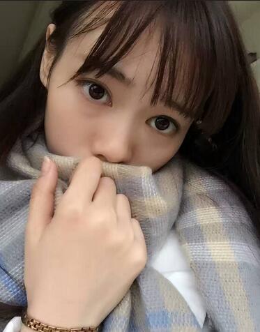 深圳晨曦三点定位双眼皮日记