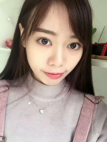 深圳晨曦三点定位双眼皮日记