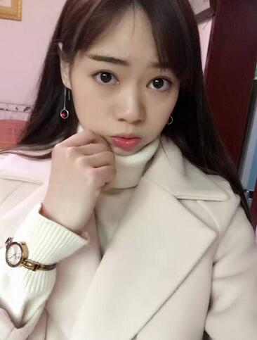 深圳晨曦三点定位双眼皮日记