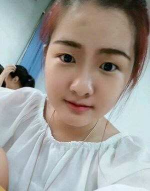 没想到切开双眼皮能这么自然，仿佛天生呀