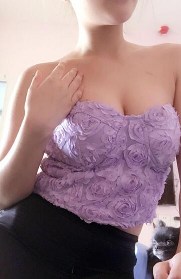 自体脂肪丰胸对比图 抽脂隆胸十天