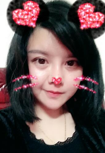 假体隆鼻两个月后的感觉 隆鼻整形手术恢复日记