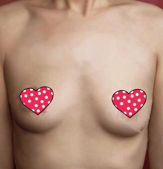 抽脂隆胸一个月 果自然