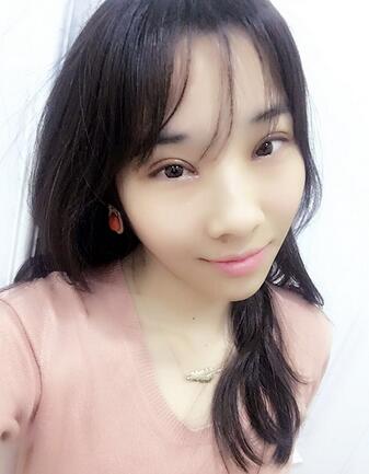 开眼角加双眼皮15天恢复图