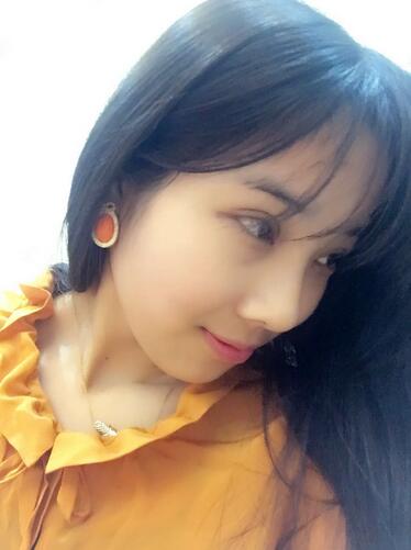 开眼角加双眼皮15天恢复图