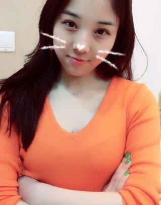 开眼角加双眼皮15天恢复图