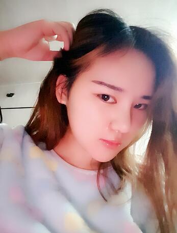 假体垫下巴一个月 前后对比