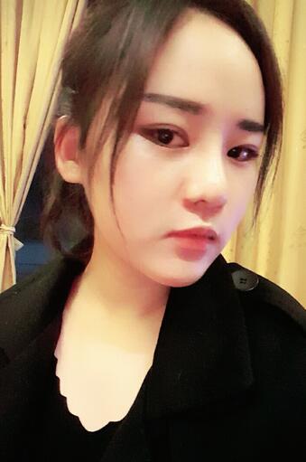 假体垫下巴一个月 前后对比