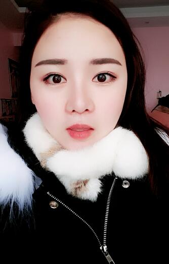 假体垫下巴一个月 前后对比