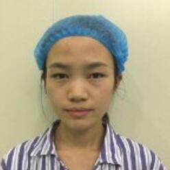 自体脂肪填充后十天图