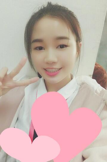 自体脂肪填充后十天图