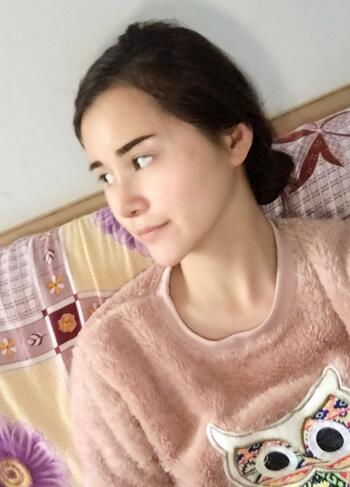 隆鼻整形3个月恢复日记