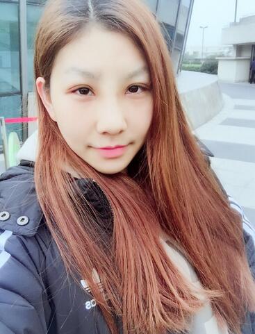 双眼皮多项整形+隆鼻整形2个月恢复之路