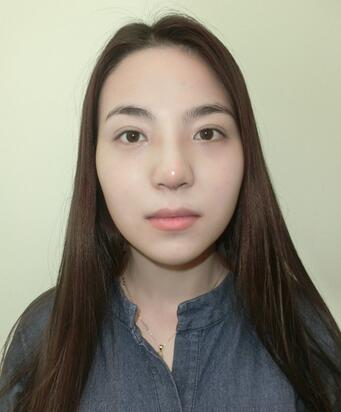 隆鼻整形恢复期照片记录 假体隆鼻+耳软骨垫鼻尖