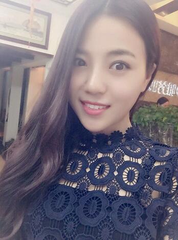 隆鼻整形恢复期照片记录 假体隆鼻+耳软骨垫鼻尖