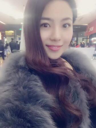 隆鼻整形恢复期照片记录 假体隆鼻+耳软骨垫鼻尖