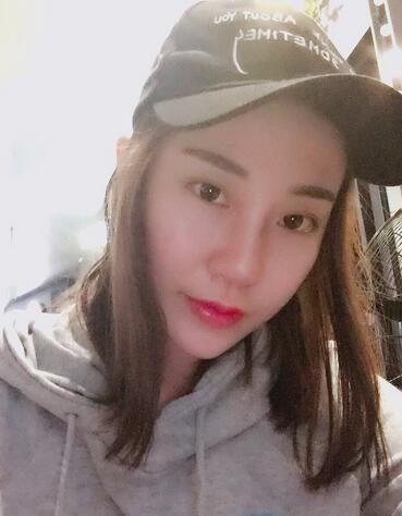 沈国雄隆鼻果 隆鼻整形恢复一个月