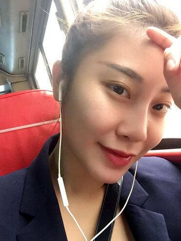 沈国雄隆鼻果 隆鼻整形恢复一个月