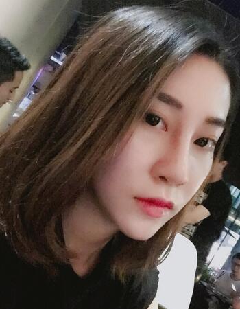 沈国雄隆鼻果 隆鼻整形恢复一个月