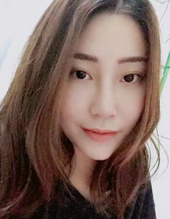 沈国雄隆鼻果 隆鼻整形恢复一个月