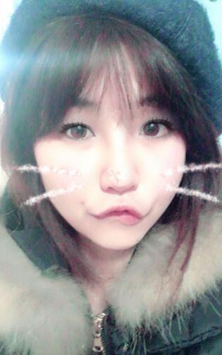 百*丽隆鼻整形恢复纪实 隆鼻+鼻头缩小+鼻小柱延长+耳软骨垫鼻尖