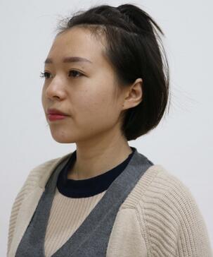 隆鼻整形多久消肿 假体隆鼻+垫鼻尖+鼻头缩小恢复日记
