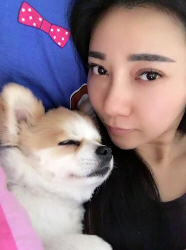 隆鼻整形恢复期日记 赵博士假体垫鼻子+软骨垫鼻尖
