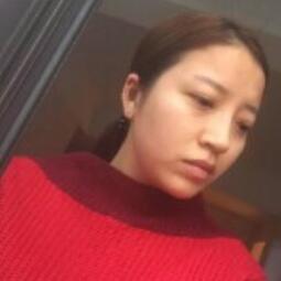 自体脂肪填充全脸1个月经历